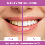 🦷 Trakovi za beljenje zob brez peroksida – naravna formula za sijoč nasmeh - slika 2