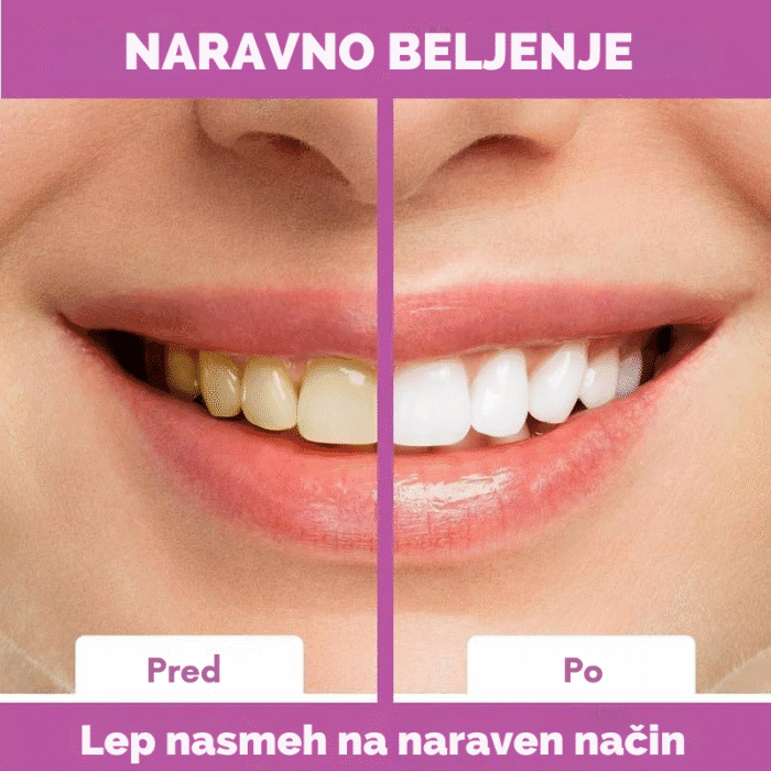 🦷 Trakovi za beljenje zob brez peroksida – naravna formula za sijoč nasmeh - slika 2